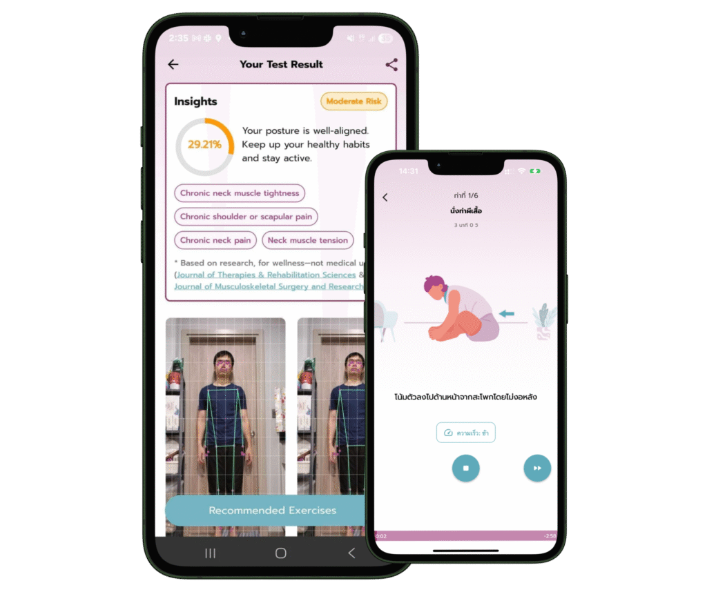ฉี่ไม่ออก-ERTIGO โปรแกรมเปิดสะโพก
